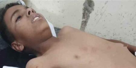 إصابة طفل وشقيقته بانفجار عبوة ناسفة زرعتها مليشيا الحوثي جنوبي تعز