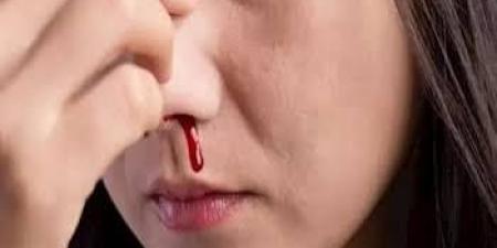 مع دخول الشتاء.. لماذا تكثر حالات نزيف الأنف وما هي طرق الوقاية؟