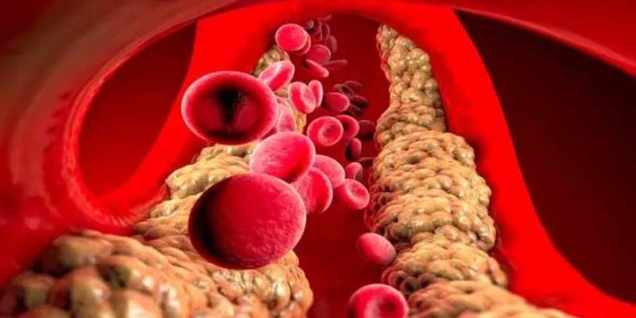 هيئة الدواء تحذر من تشغيلة لدواء شهير لعلاج الكوليسترول والدهون الثلاثية