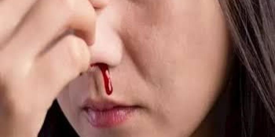 مع دخول الشتاء.. لماذا تكثر حالات نزيف الأنف وما هي طرق الوقاية؟