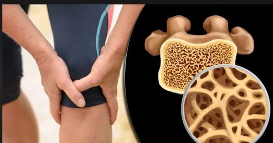 هشاشة العظام لا تصيب كبار السن فقط.. نصائح مهمة للشباب للوقاية